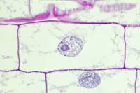 Racine de Blé - Cellule végétale en cours de division (mitose) : interphase x150 